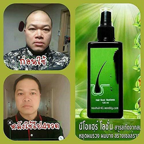 Regenerating and nourishing shampoo for dandruff removal